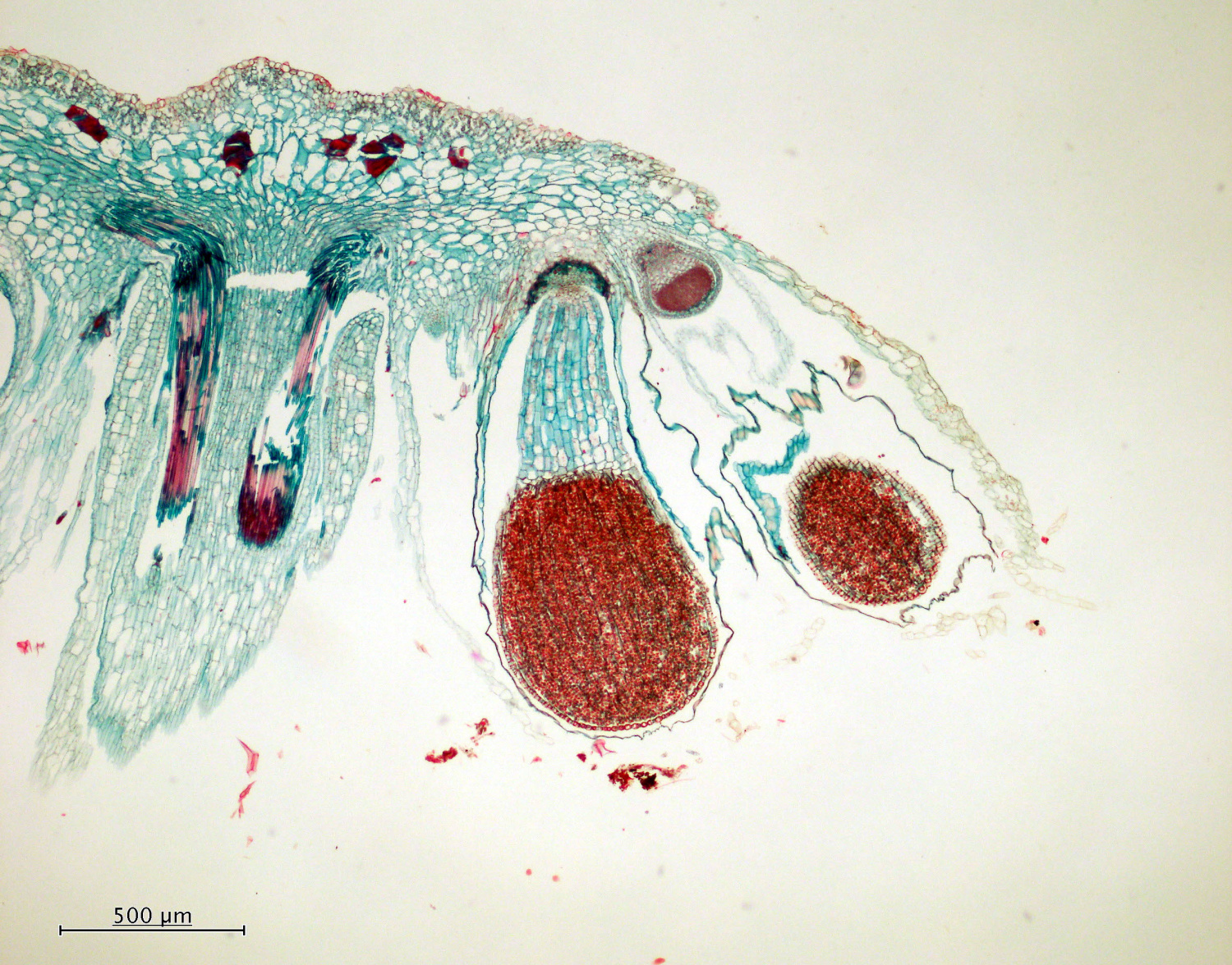 Sporophyte de<i> Marchantia </i>(vue générale)  