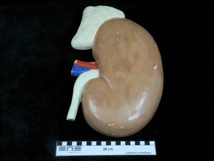 Modèle anatomique de rein humain Modèle Auzoux de rein en plâtre