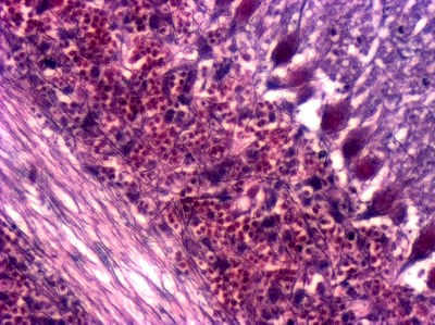 Cellules de Purkinje de cervelet de souris (X40)