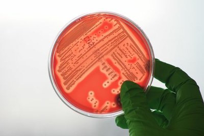 UE Host and Microbes