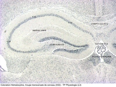 Coupe transversale de cerveau de souris (X50)
