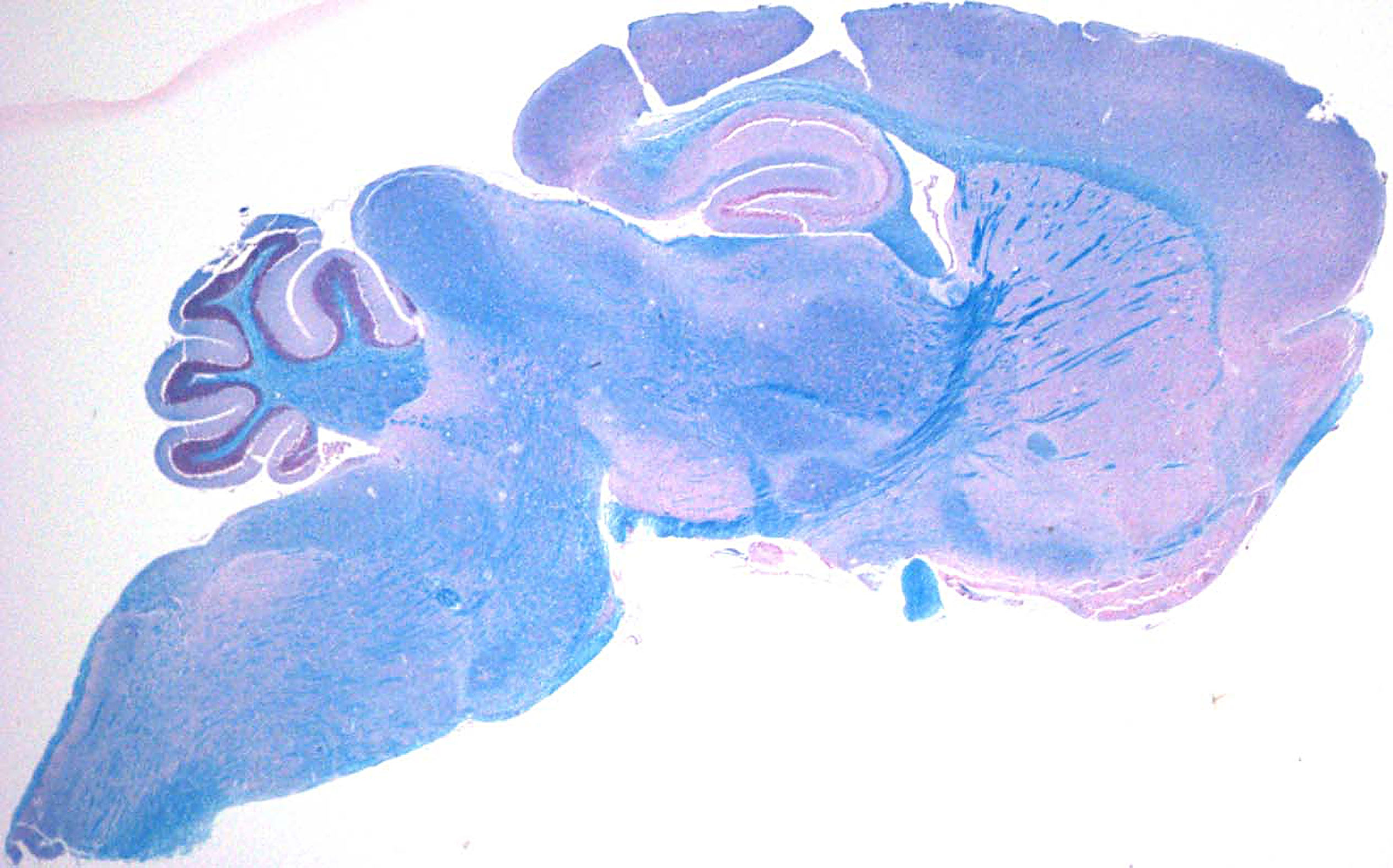 TP de Neurophysiologie